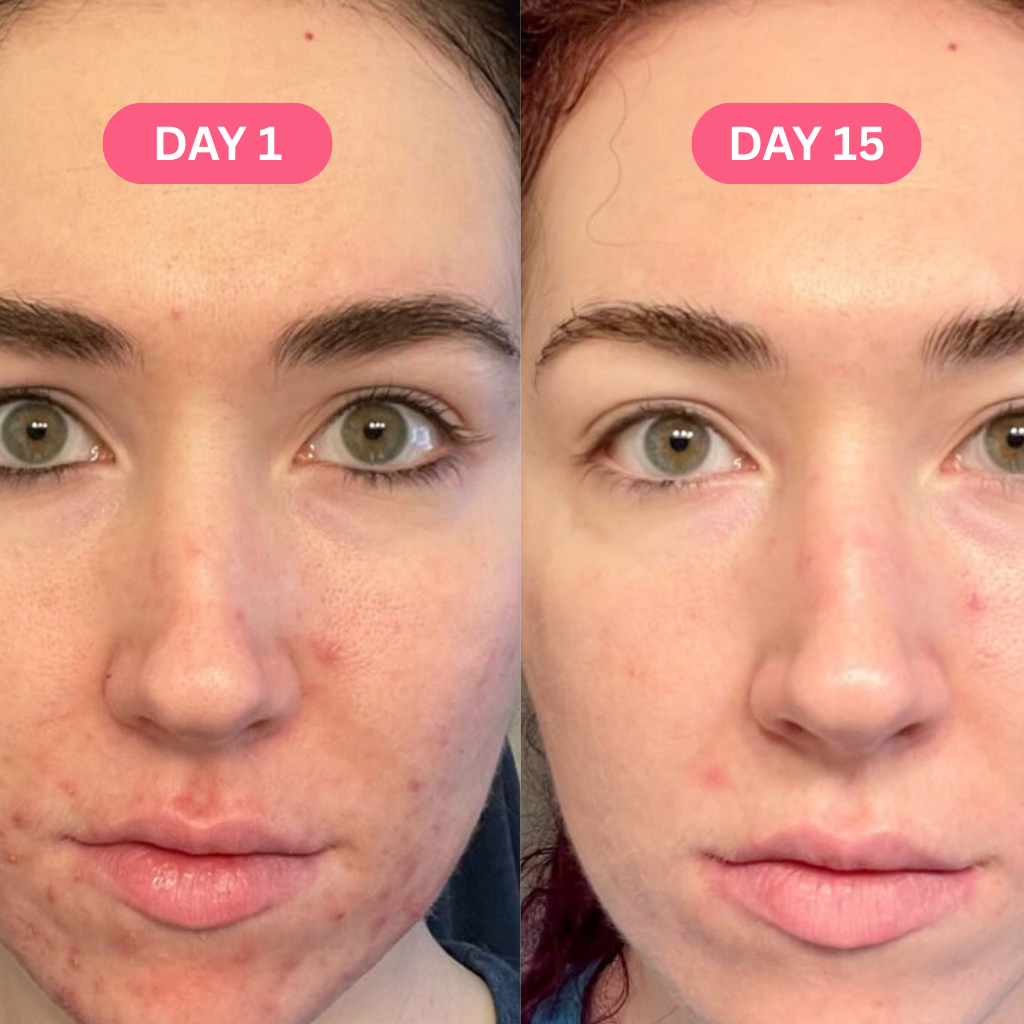 Skin Perfecting Tumeric Pads