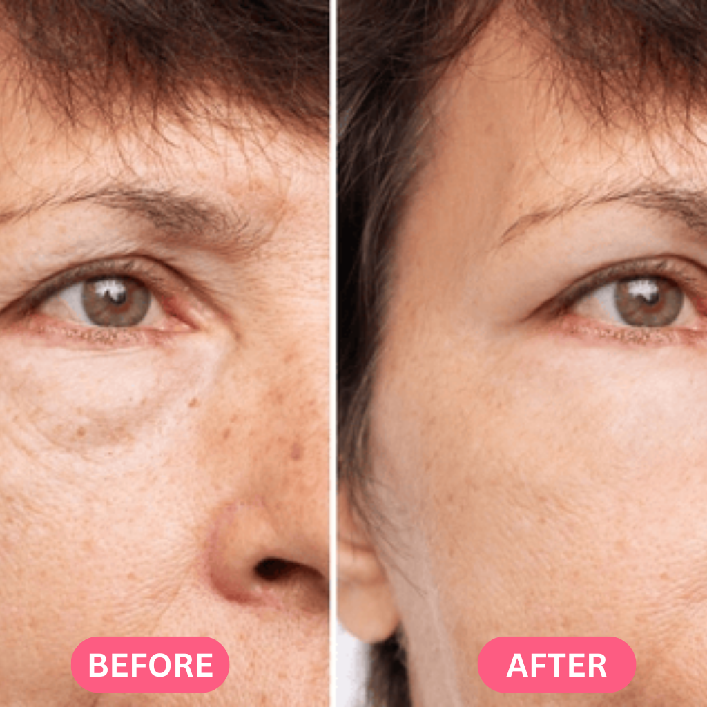 Hyaluronic Acid Serum Pads