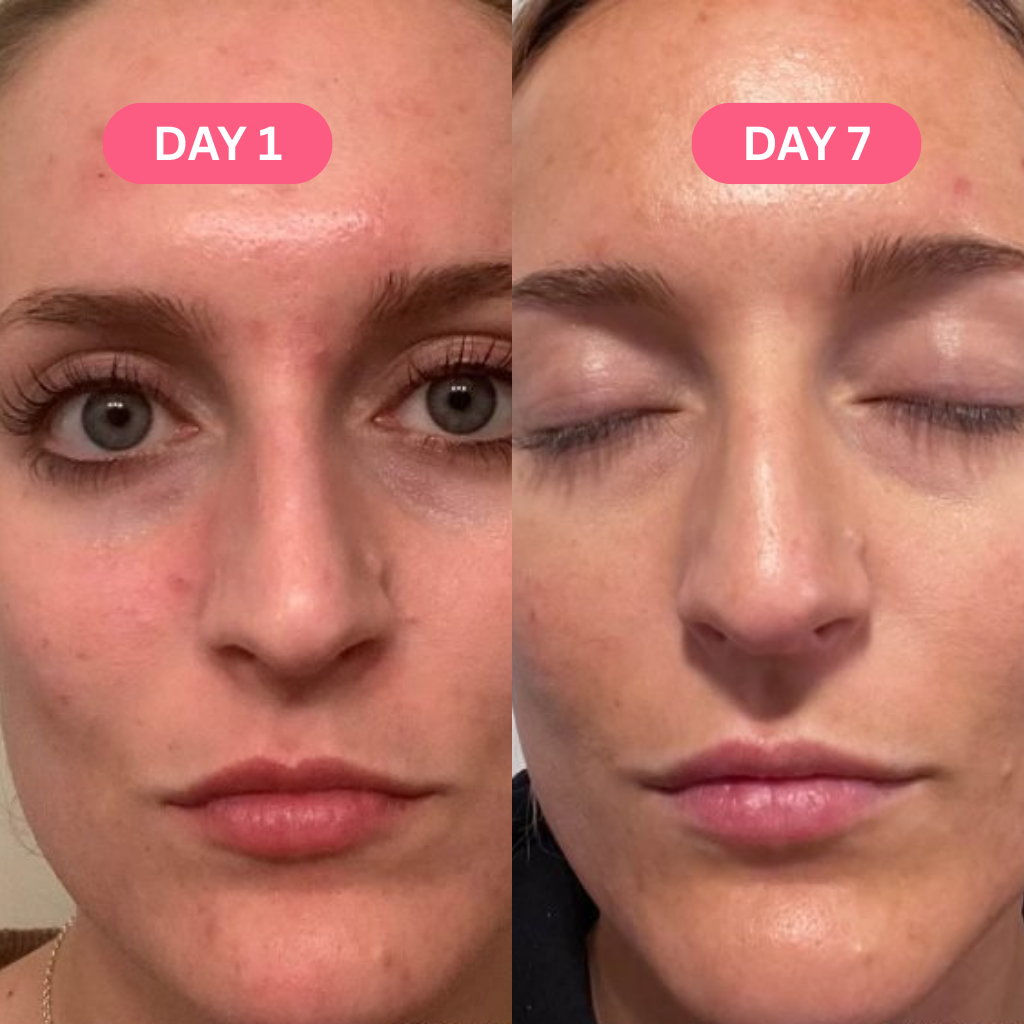 Skin Perfecting Tumeric Pads