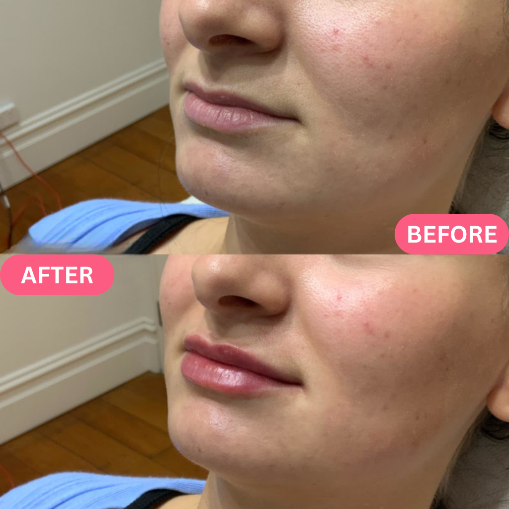 Hyaluronic Acid Serum Pads