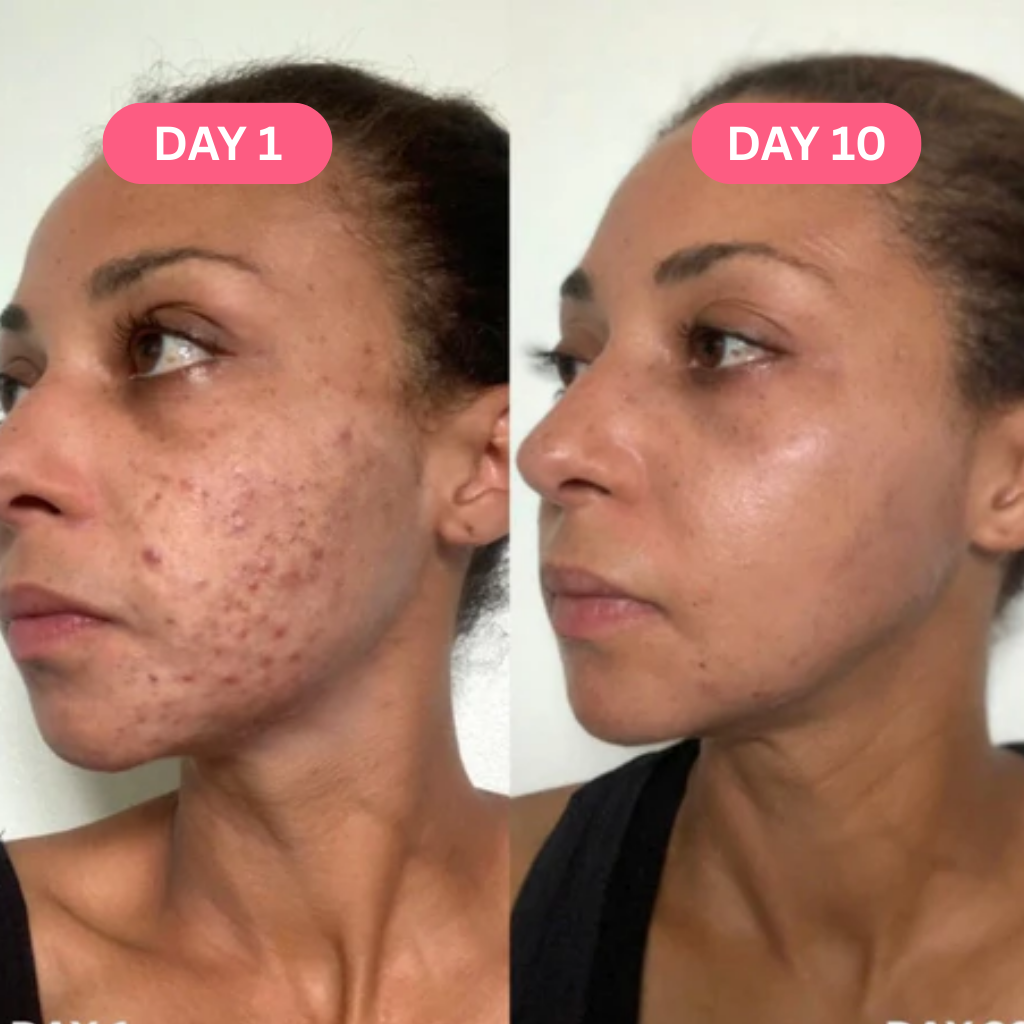 Skin Perfecting Tumeric Pads