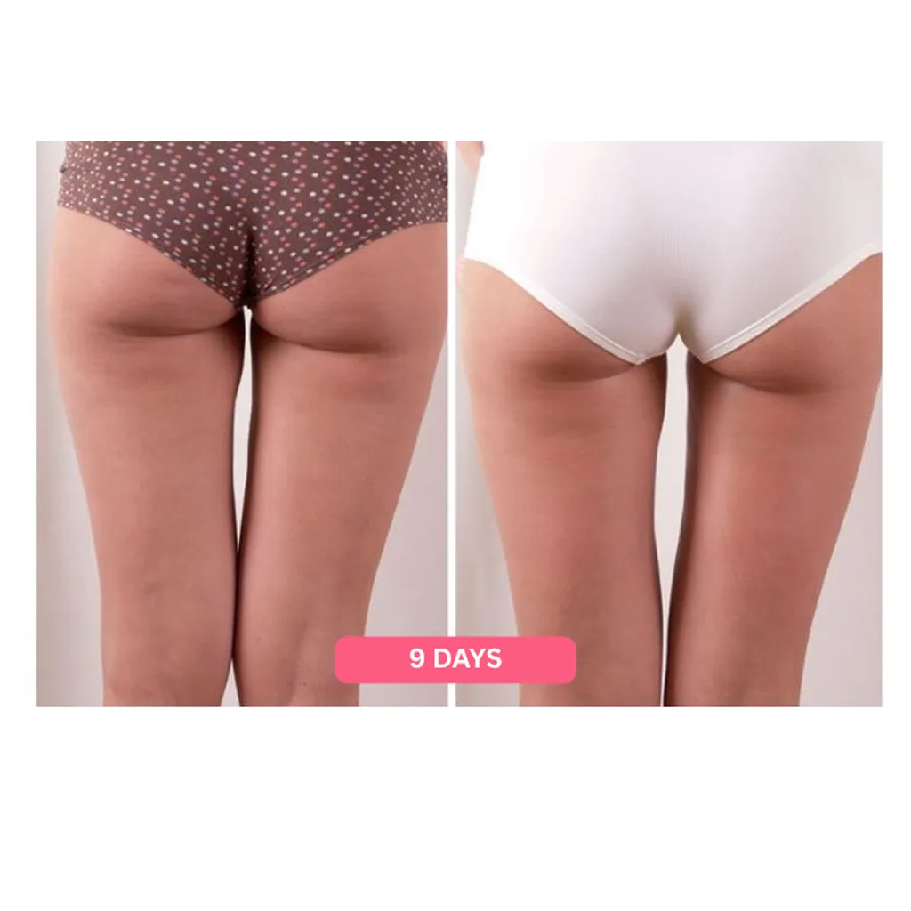 Herology Cellulite Relief Kit