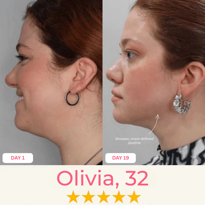 Double Chin Lifting Mask