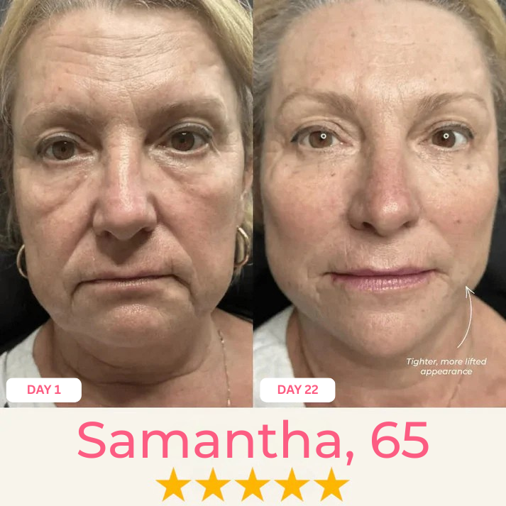 Double Chin Lifting Mask