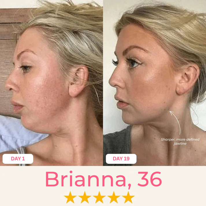 Double Chin Lifting Mask